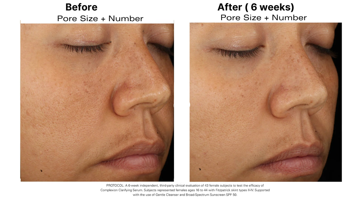 Complexion Clarifying Serum