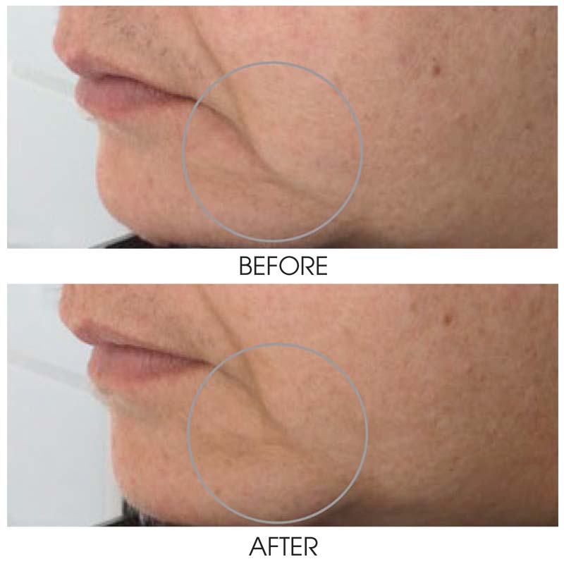 Firming Serum