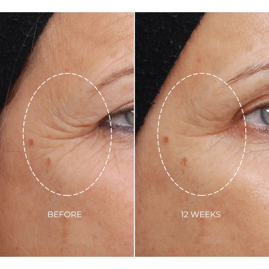 NEWA Plus