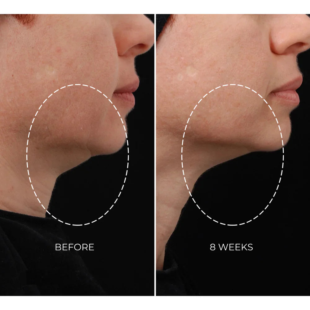 NEWA Plus