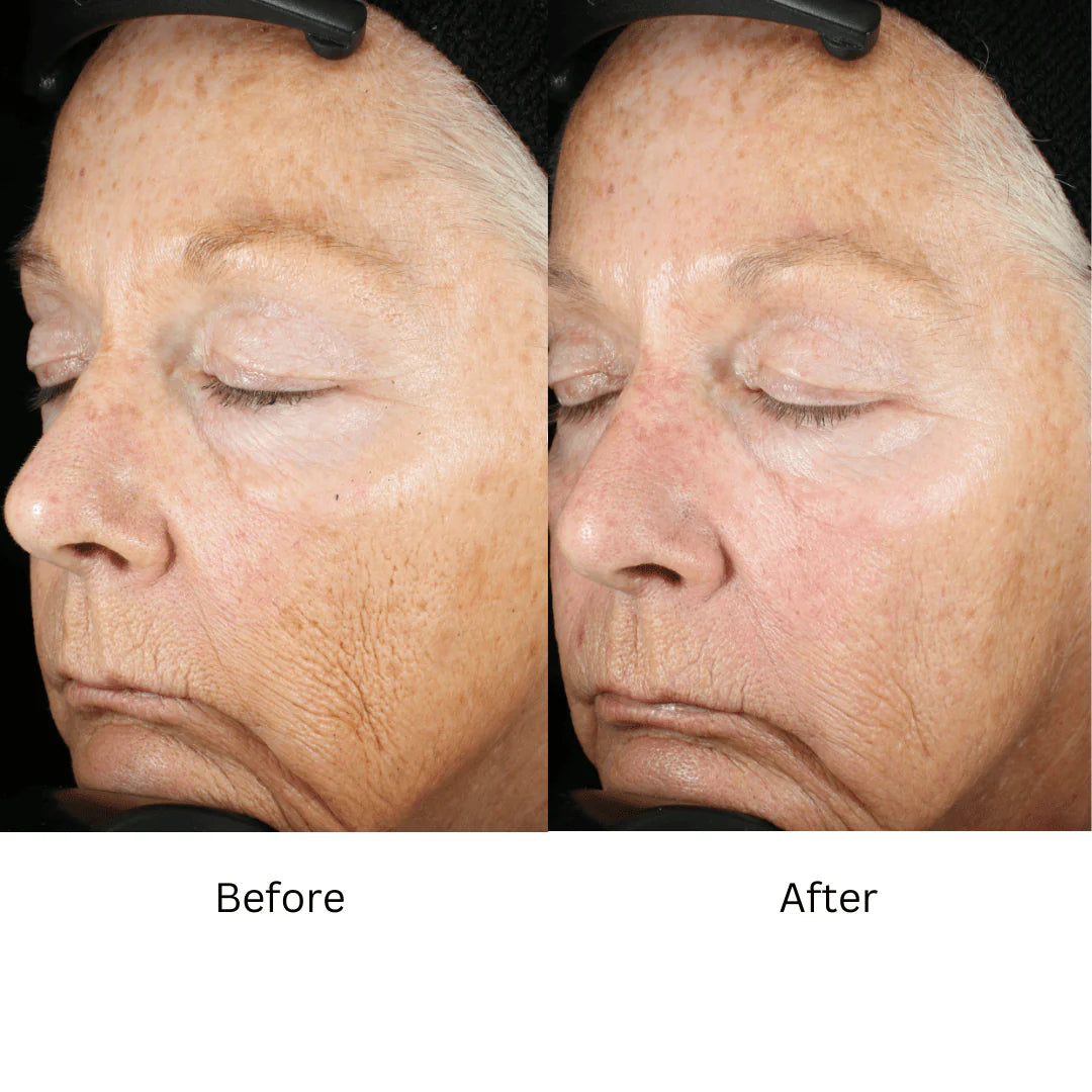 Wrinkle + Texture Repair