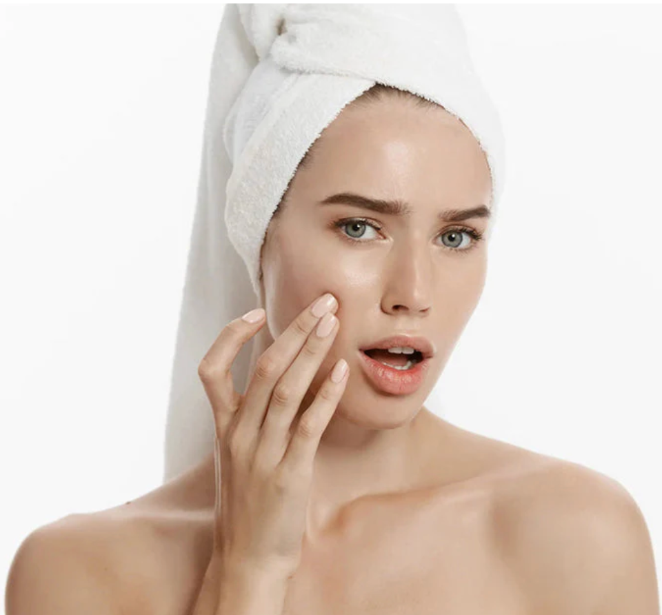 Προϊόντα για Ακμή: Ο Απόλυτος Οδηγός (Skincare Routine, Προϊόντα, Τι Δουλεύει πραγματικά)