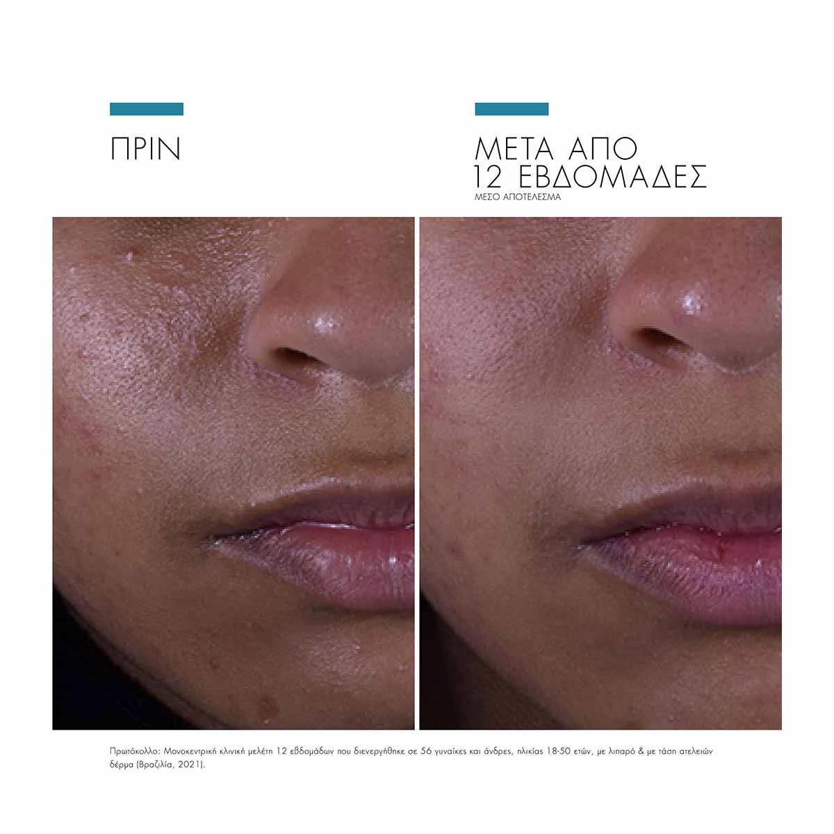 Silymarin CF