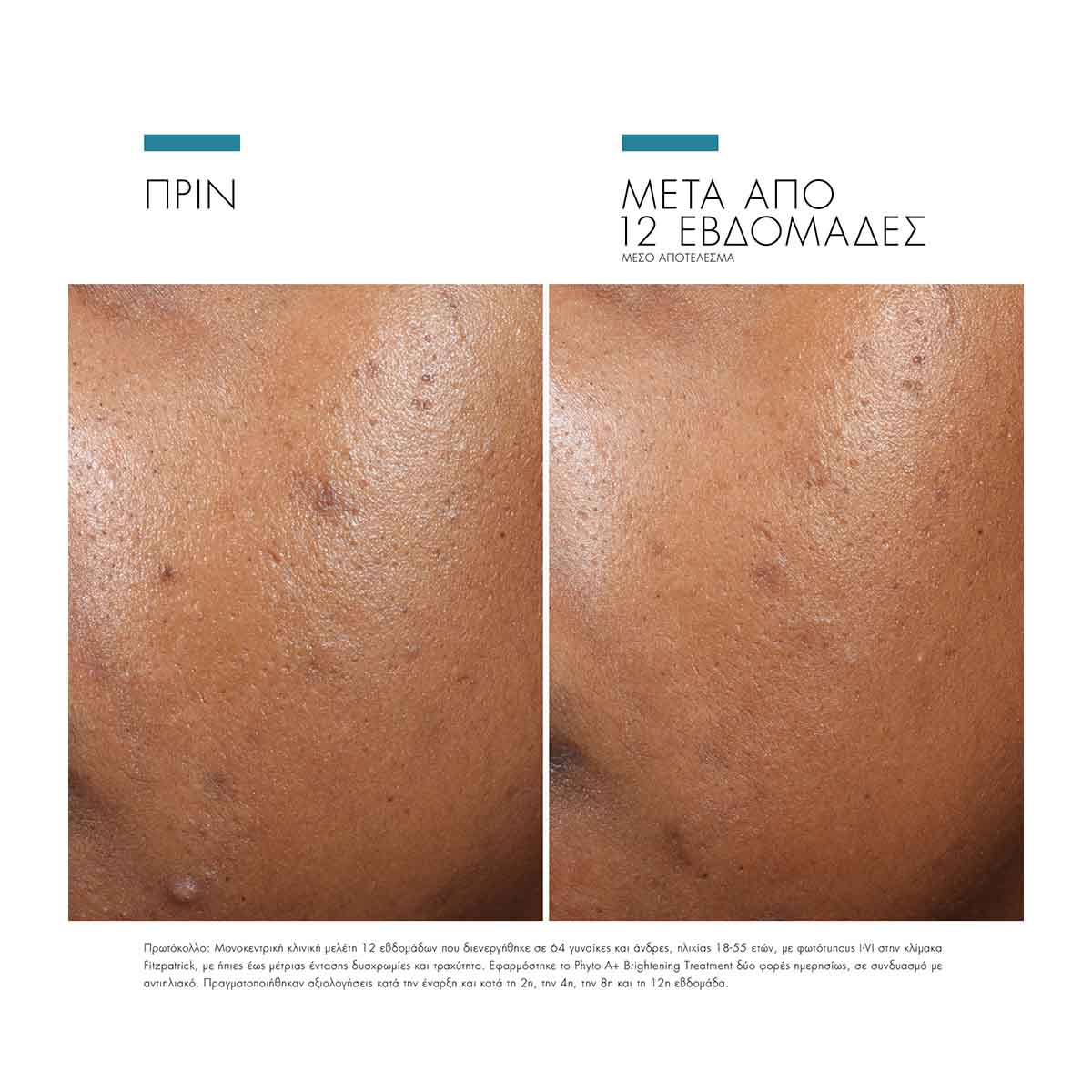 Phyto A+ Brightening Treatment
