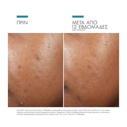 Phyto A+ Brightening Treatment