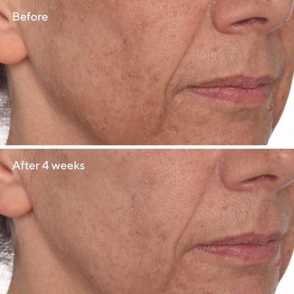 Murad Vita - C Glycolic Serum 30ml