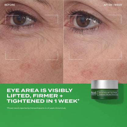 Murad Retinal ReSculpt Eye Treatment 15ml
