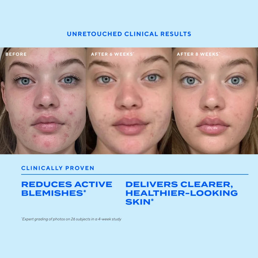 Murad Biome-Balancing Clear &amp; Prevent Blemish Treatment Serum