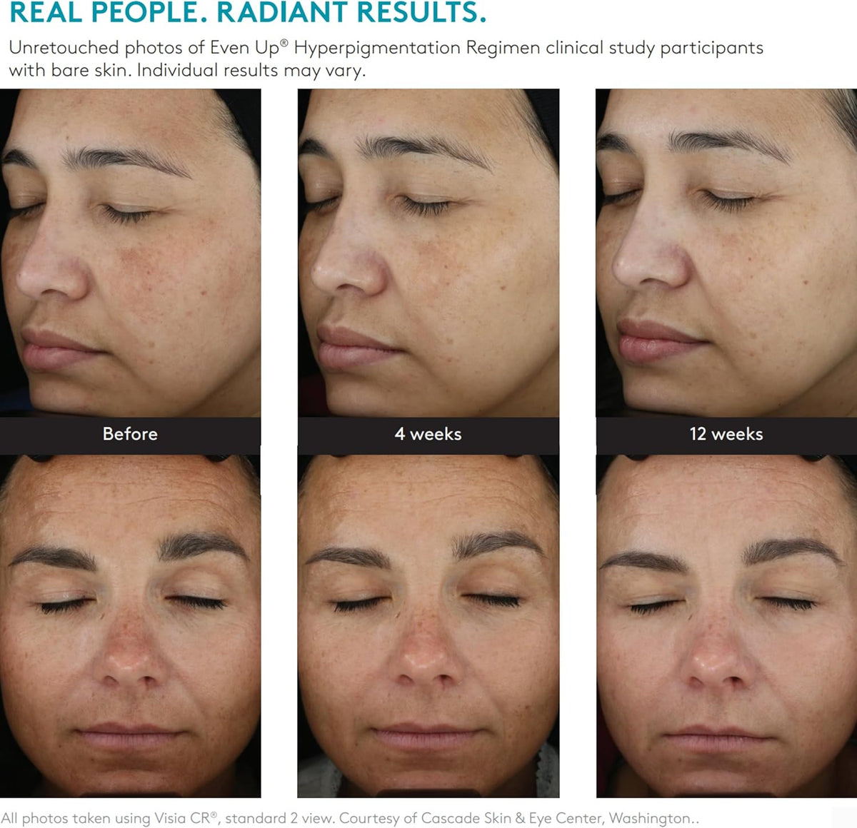Even Up Multi-Correction Serum