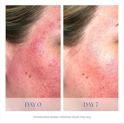 Pro-Heal Serum Advance+