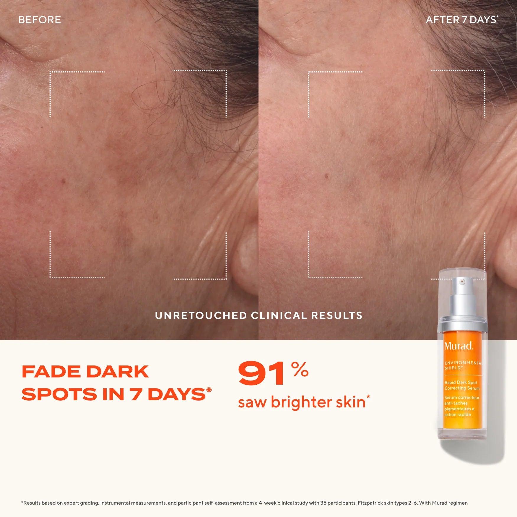 Murad Rapid Dark Spot Correcting Serum 30ml