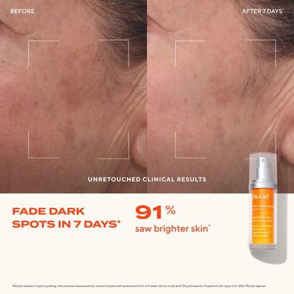Murad Rapid Dark Spot Correcting Serum 30ml