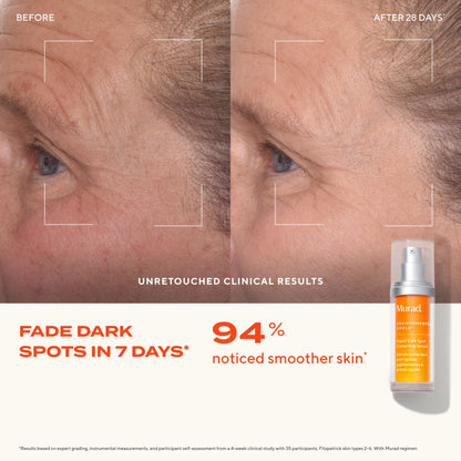 Murad Rapid Dark Spot Correcting Serum 30ml