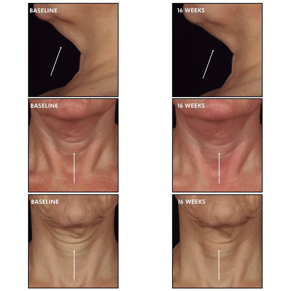 Tripeptide-R Neck Repair