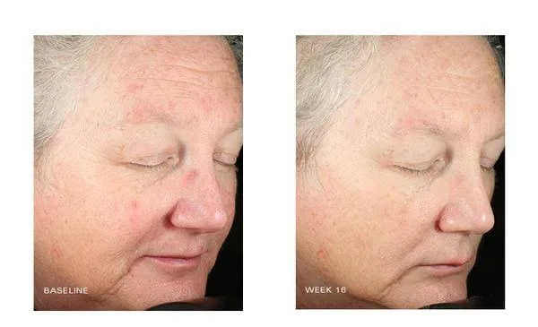 Brightalive Skin Brightener
