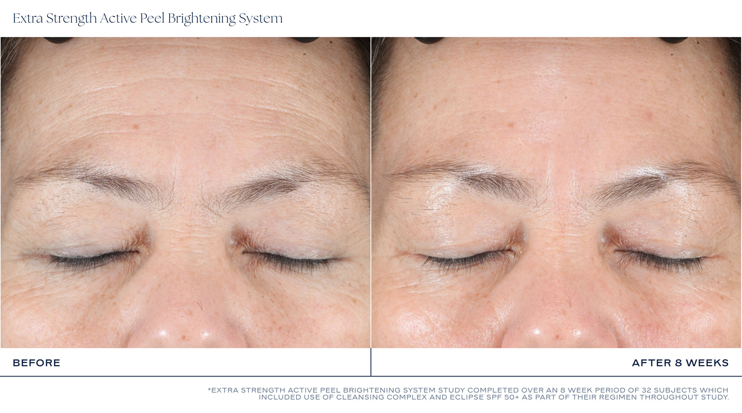 Extra Strength Active Peel Brightening System (15Duos)