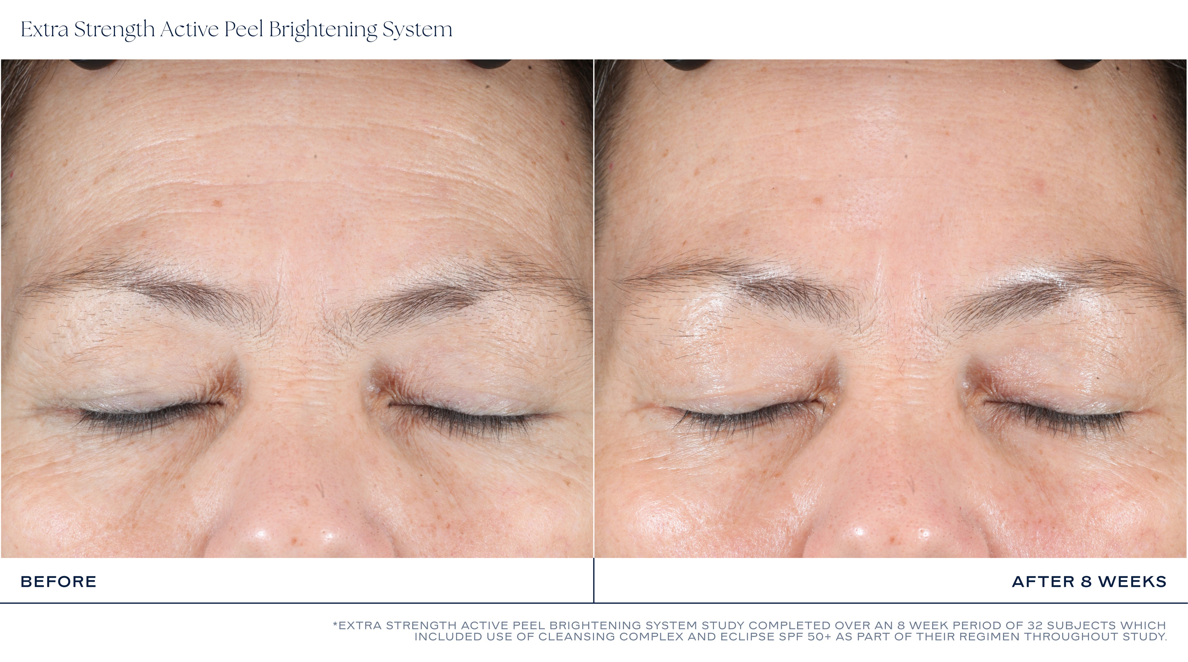 Extra Strength Active Peel Brightening System (15Duos)