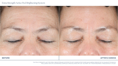 Extra Strength Active Peel Brightening System (15Duos)
