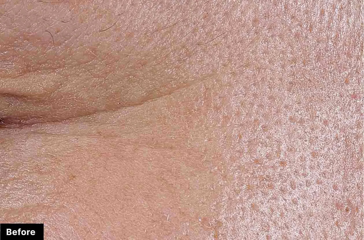 P-TIOX