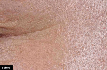P-TIOX