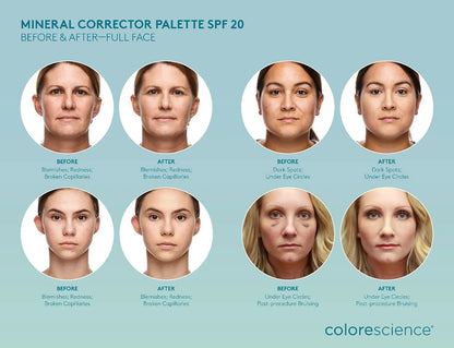 Mineral Corrector Palette SPF 20