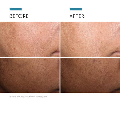 Discoloration Defense Serum
