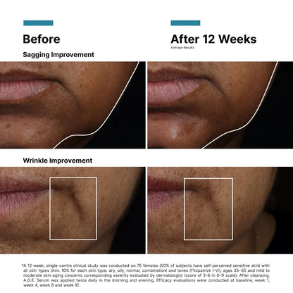 Α.G.E Interrupter Ultra Serum