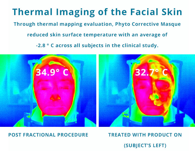 Phyto Corrective Masque