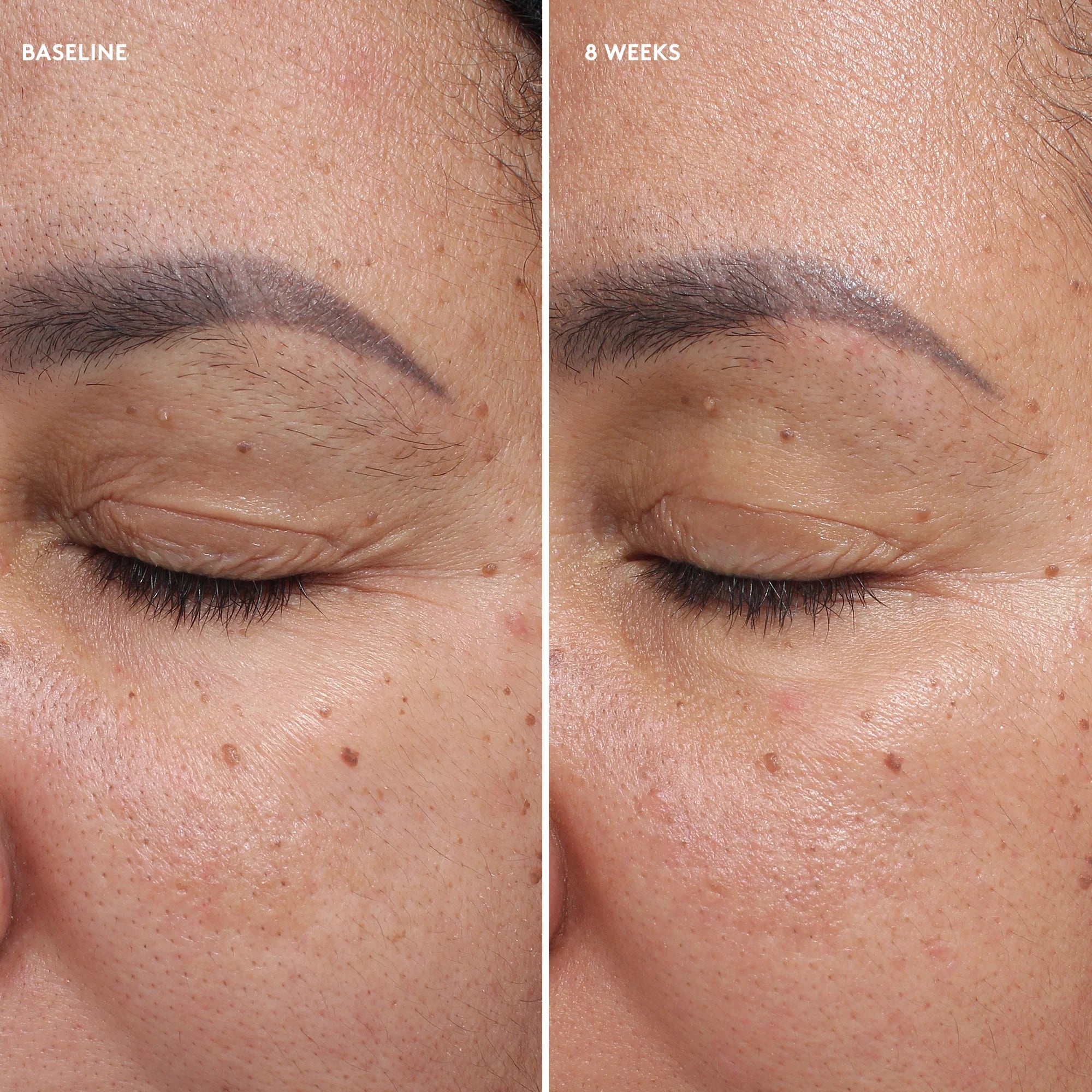 Total Eye Firm &amp; Repair Cream