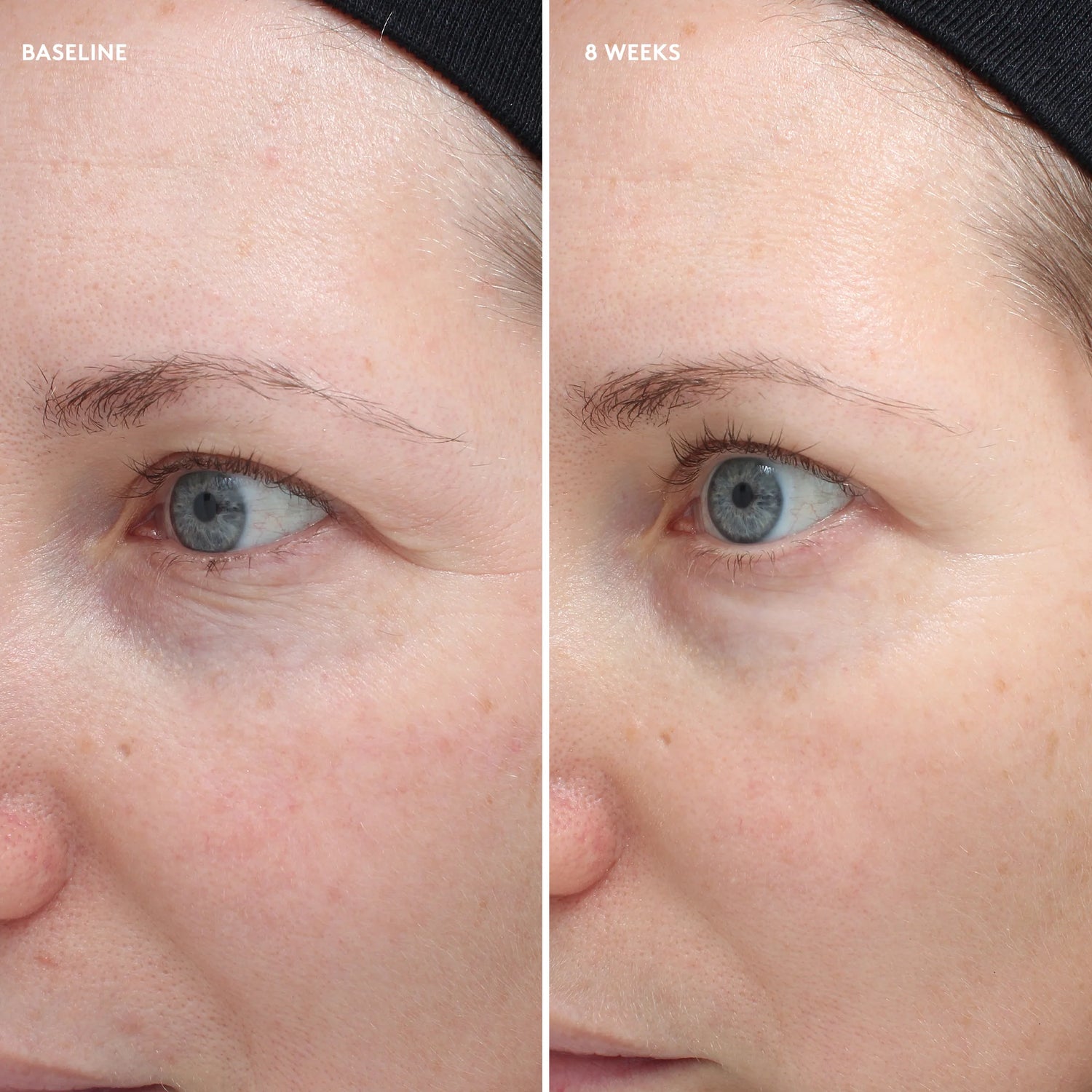 Total Eye Firm &amp; Repair Cream