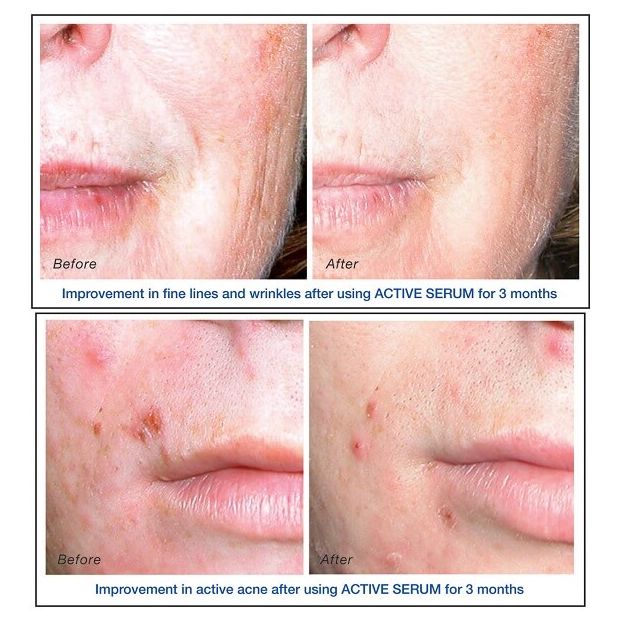 Active Serum
