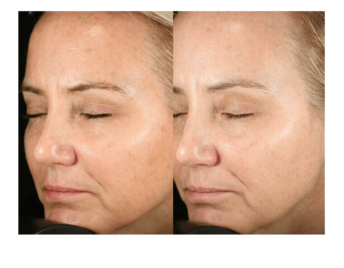 Brightalive Skin Brightener