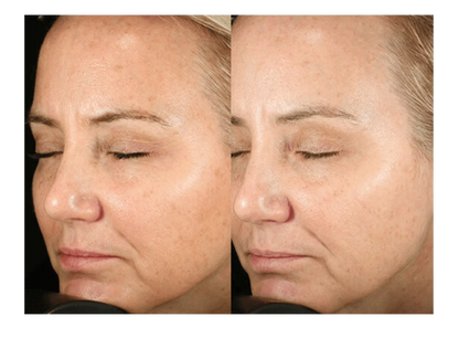 Brightalive Skin Brightener