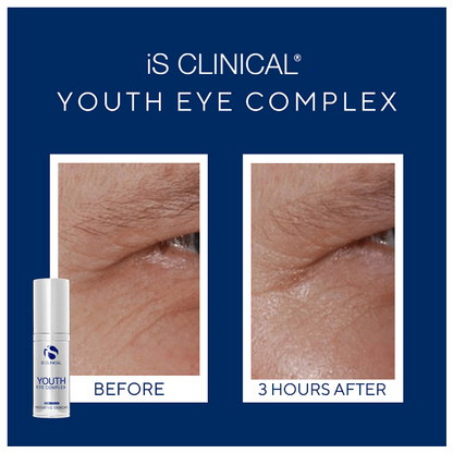 Youth Eye Complex