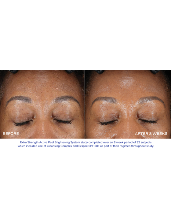 Extra Strength Active Peel Brightening System (15Duos)