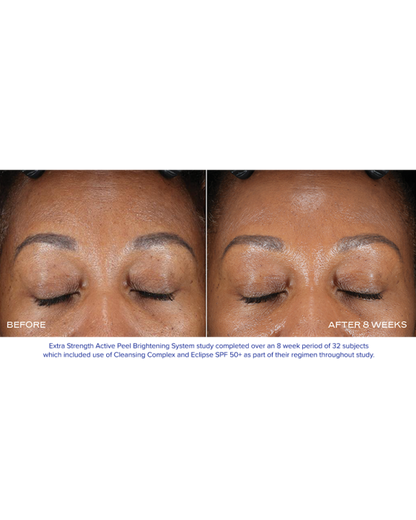 Extra Strength Active Peel Brightening System (15Duos)
