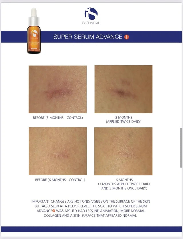 Super Serum Advance+