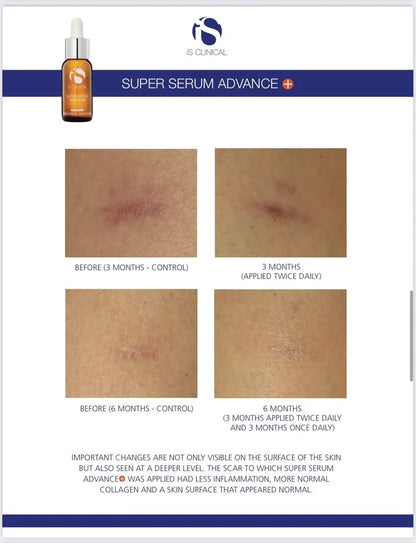 Super Serum Advance+