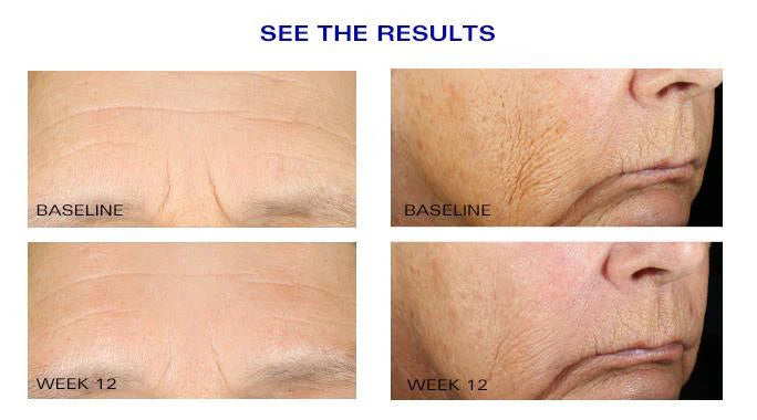 Wrinkle + Texture Repair