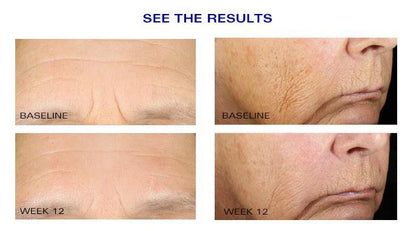 Wrinkle + Texture Repair
