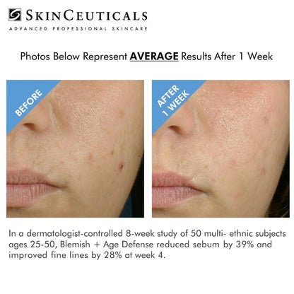 Blemish &amp; Age Defense