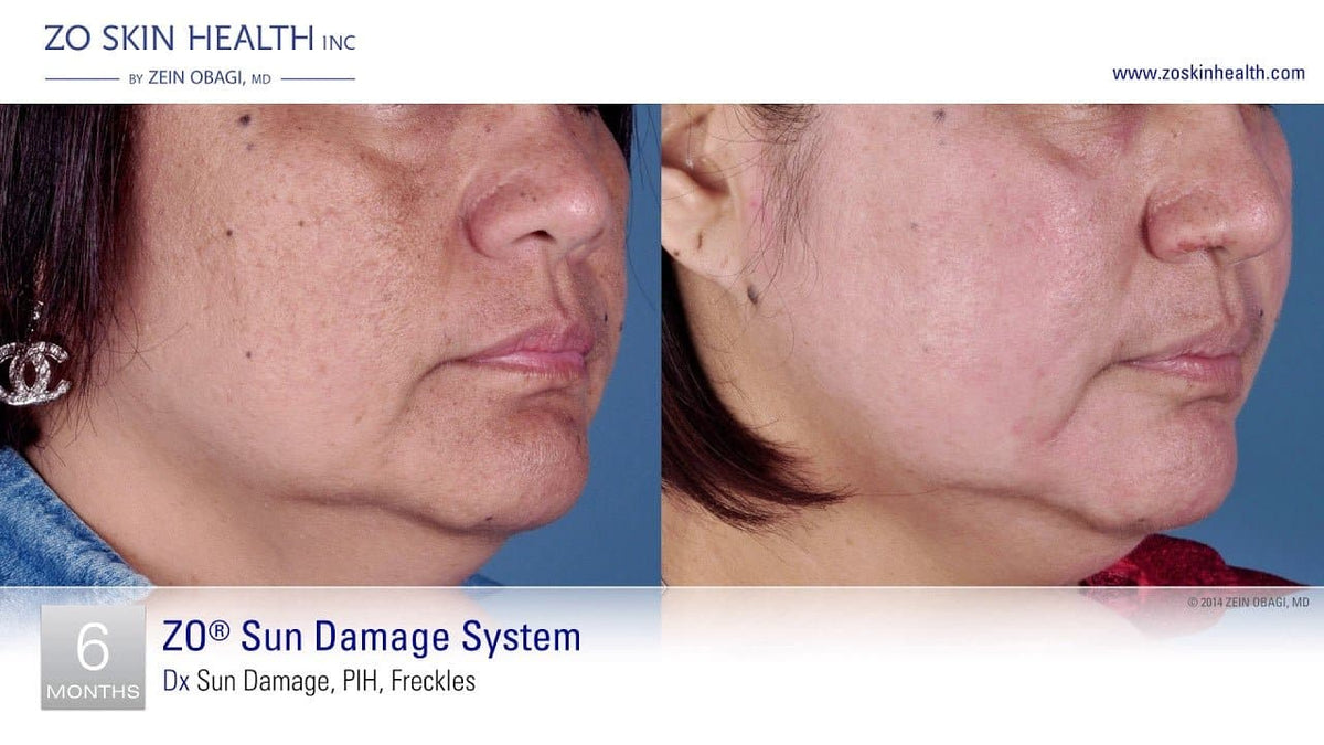 Firming Serum