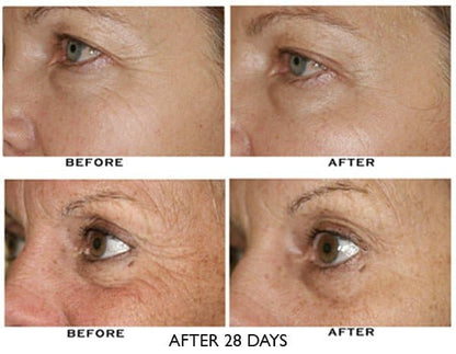 Growth Factor Eye Serum