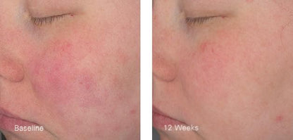 Hydrating Crème